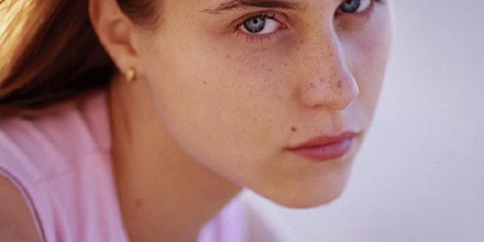 Comment Le Grain De Beaute Devient Immortel Et Se Transforme En Melanome