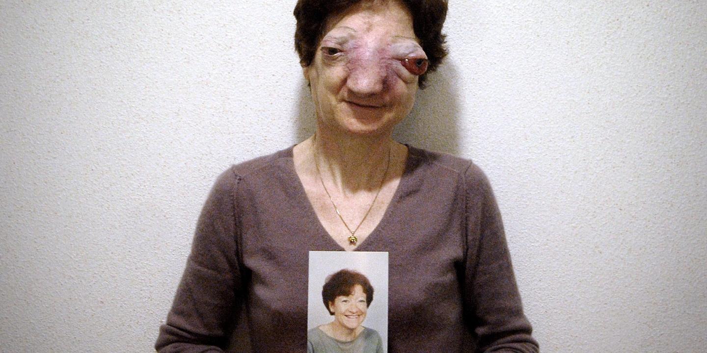 Chantal Sébire, maîtresse de sa mort comme de sa vie