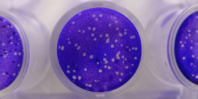 Des virus cultivés dans une boîte de Petri. 
