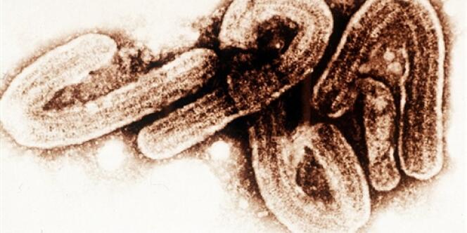 Le virus Ebola vu au microscope.