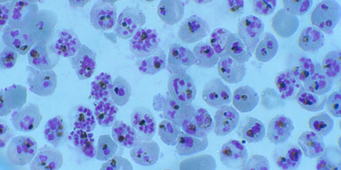 Frottis de sang humain infecté par Plasmodium falciparum (un des agents du paludisme).