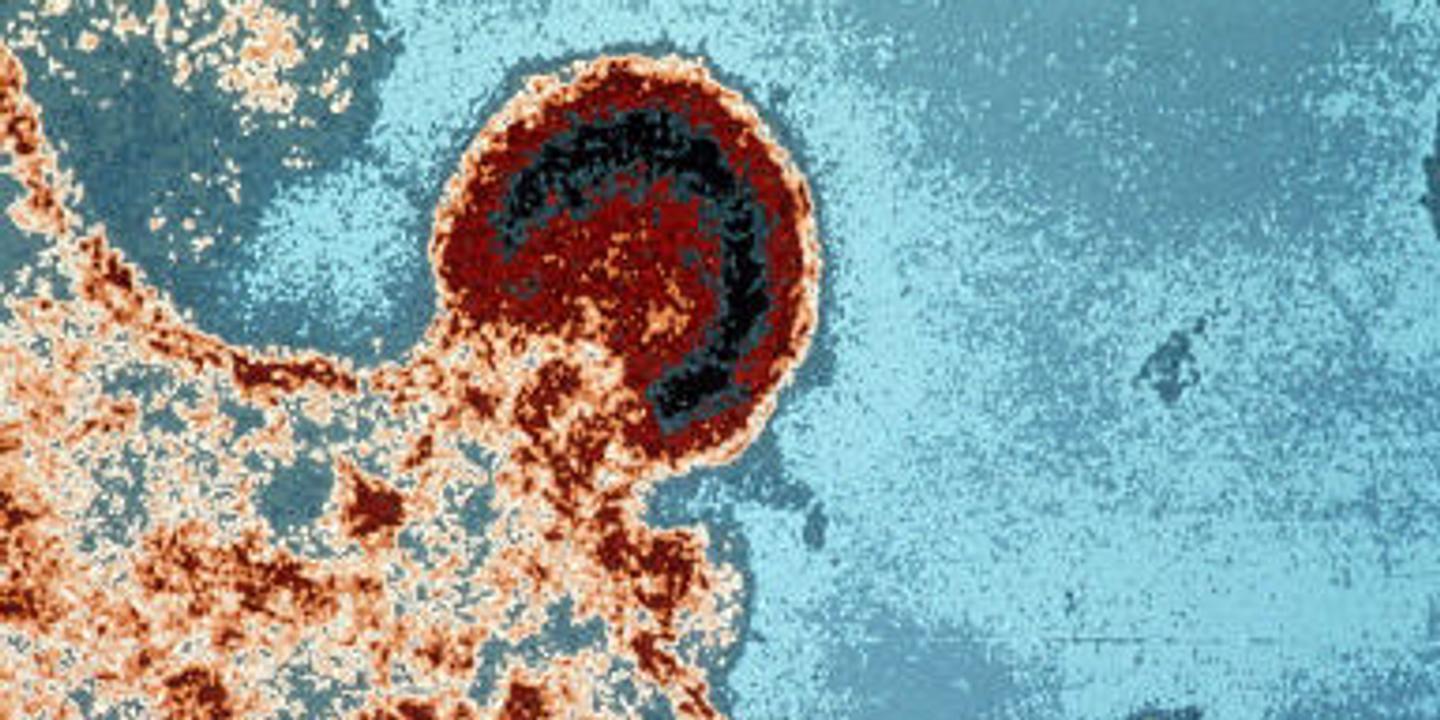 Trente Ans D Avancees Scientifiques Contre Le Sida