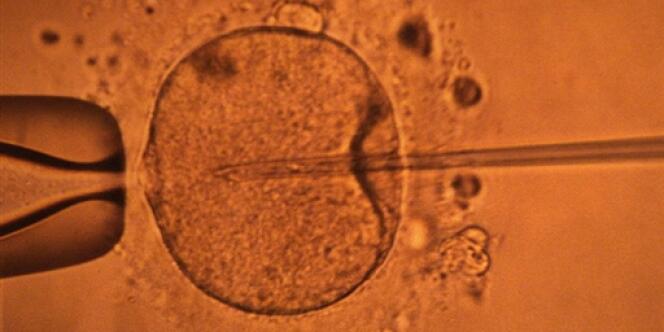 Au C.E.C.O.S (Centre d'étude et de conservation du sperme humain) de Rennes, un écran de contrôle représentant la micro-injection par pipette d'un spermatozoide dans un ovocyte. 