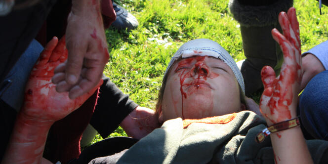 Un jeune homme blessé au visage lors d'une manifestation devant un local du Medef à Caen, mardi 12 octobre.