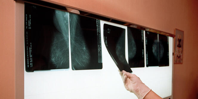 Un médecin examine, le 14 juillet 2001 dans son cabinet médical à Arcueil, près de Paris, les radios du sein d'une patiente afin de détecter un éventuel cancer.