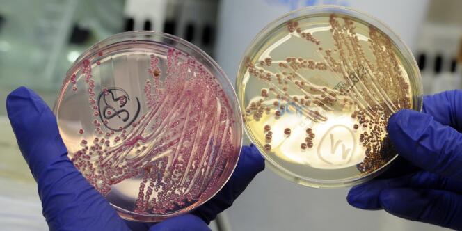 Des bactéries analysées dans un laboratoire à Hambourg en juin 2011.