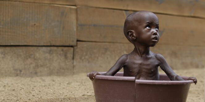 La malnutrition frappe 165 millions d'enfants dans le monde.