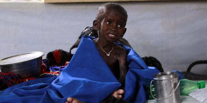 Un enfant souffrant de malnutrition dans un camp de réfugiés à la frontière entre le Kenya et la Somalie, le 28 juillet 2011.