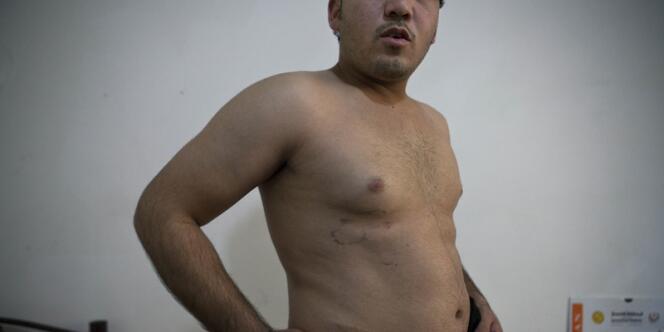 Ghazi (nom d'emprunt) 22 years, a été torturé à plusieurs reprises, notamment en étant pendu par les bras.