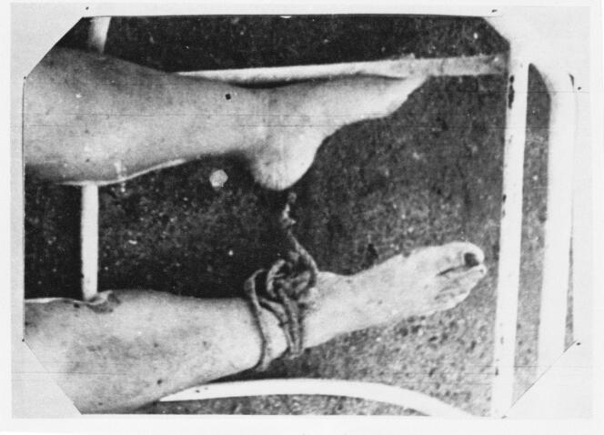 Photographie d'un corps retrouvé sur les côtes uruguayennes en 1978, manifestement jeté dans le rio de la Plata d'un avion de la junte argentine.