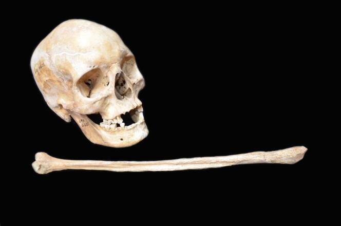 Un crâne et un fémur datant du Moyen Age, retrouvés au Danemark, portent les traces de la lèpre. 