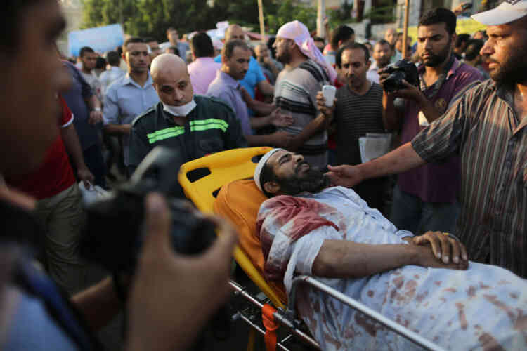 An injured man lies on a gurney as he is brought for medical treatment in Cairo following overnight violence, on July 8, 2013. Forty-two loyalists of Egypt's ousted president Mohamed Morsi were killed while demonstrating against last week's military coup, with the Egyptian military blaming "terrorists" for the violence, while witnesses, including Islamic Brotherhood supporters, telling AFP that the armed forces fired only tear gas and warning shots and that "thugs" in civilian clothes had carried out the deadly shooting.  AFP PHOTO/STR