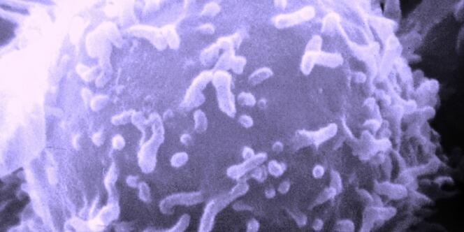 Image d'un lymphocyte produite par un microscope à balayage électronique.