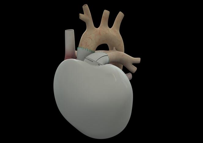 Image de synthèse du cœur artificiel conçu par la société Carmat, dont un premier exemplaire a été implanté sur un patient en insuffisance cardiaque terminale le 18 décembre 2013. Le principe est celui d'une pompe raccordée au système sanguin.