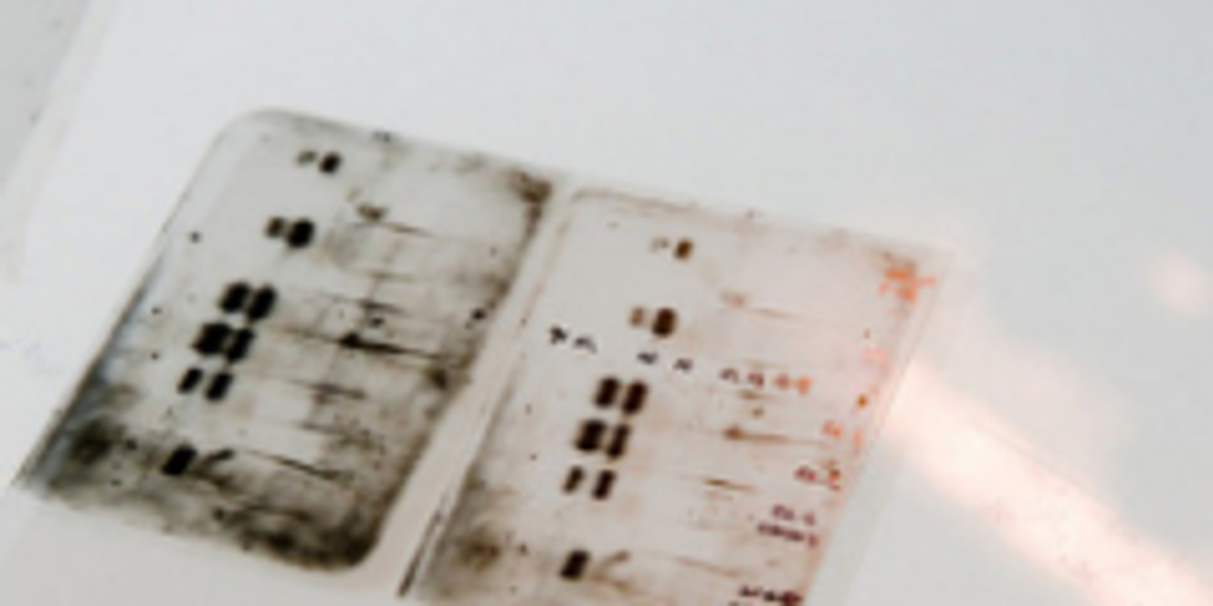 Biomédicaments : l'avenir de la pharmacie ?