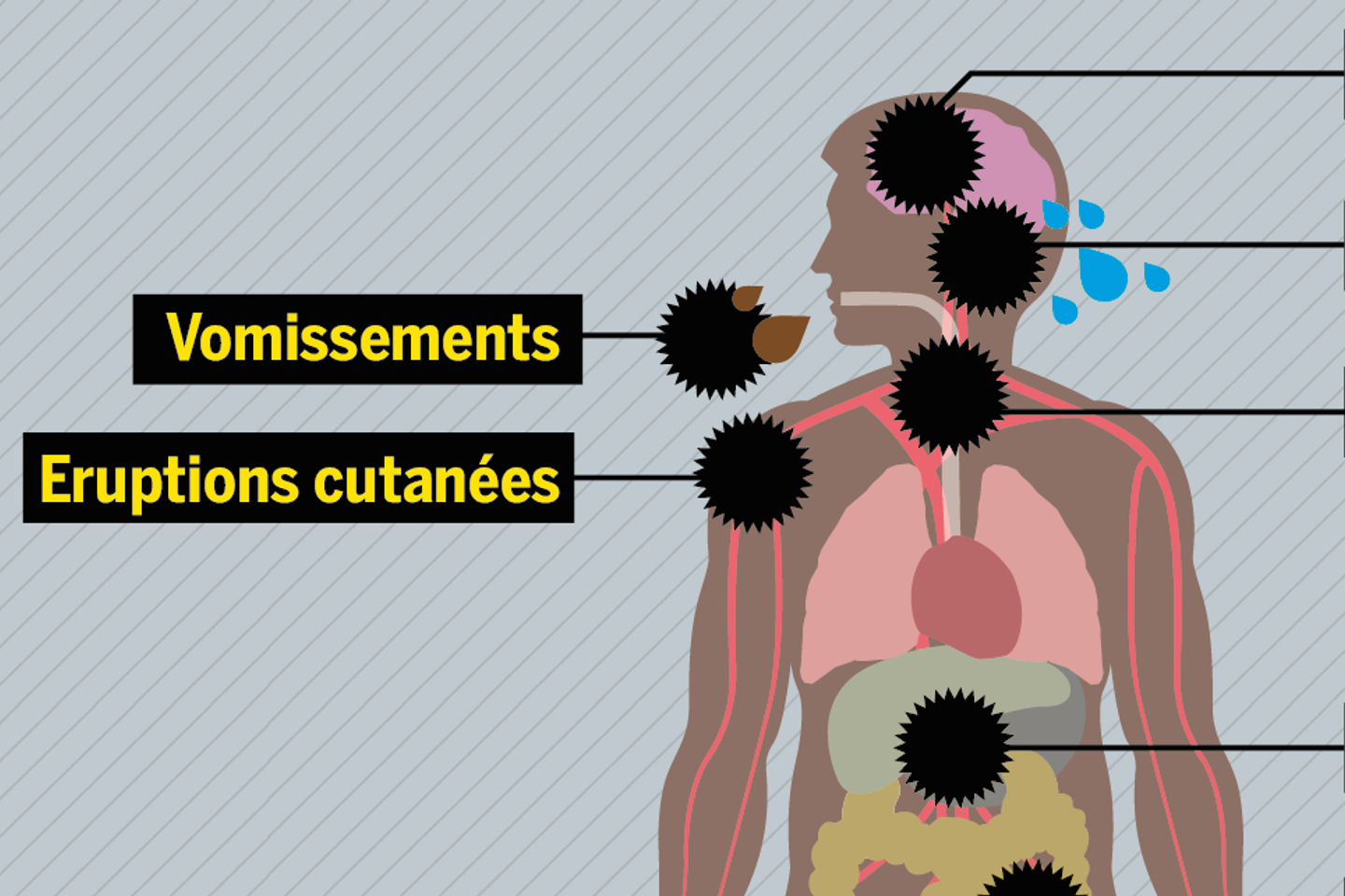 Comprendre le virus Ebola en moins de trois minutes