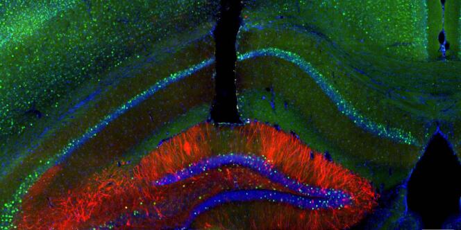 Les neurones de l’hippocampe de souris, visibles ici en rouge, ont été activés par un rayon laser arrivant via une fibre optique (canal noir au centre)., ce qui a fait revivre aux souris les souvenirs qui y étaient stockés.