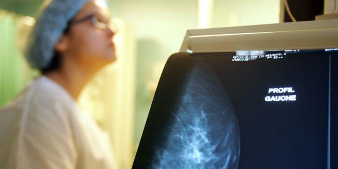 Une étude publiée mardi affirme que l'ablation des deux seins, davantage choisie par des patientes ces dernières années, n'est pas plus efficace que l'enlèvement de la tumeur suivi d'une radiothérapie.