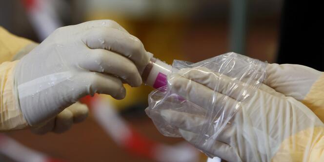 Un test de diagnostic rapide du virus Ebola a été mis au point par des chercheurs français du CEA.