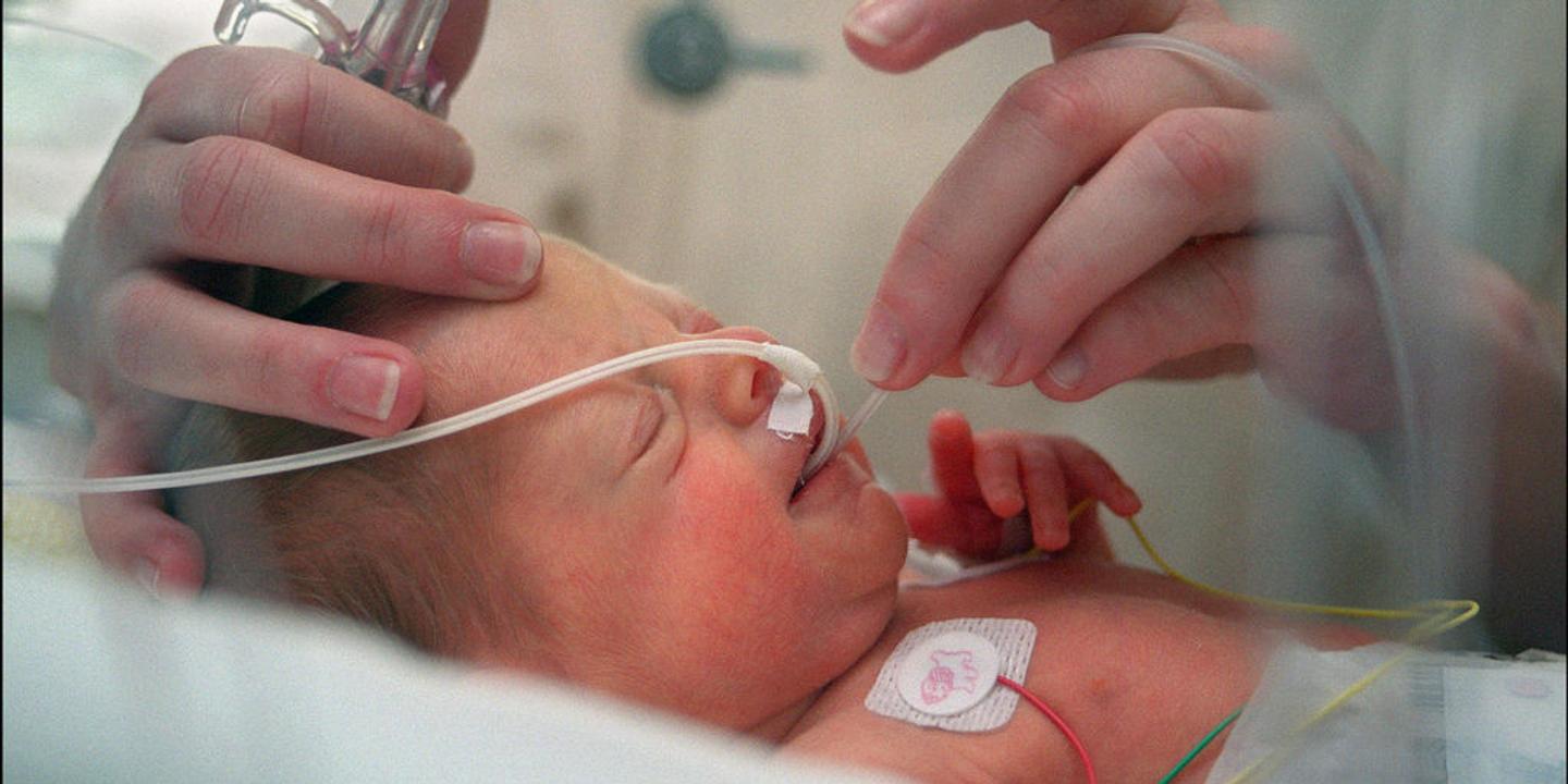 La Sante Des Grands Prematures S Ameliore