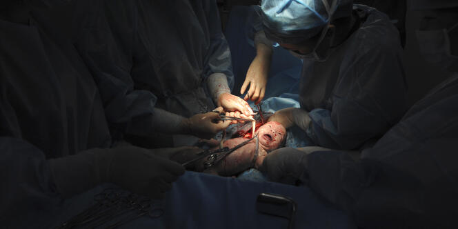 Naissance par césarienne dans un hôpital de la province chinoise du Xinjiang, en juin 2012.