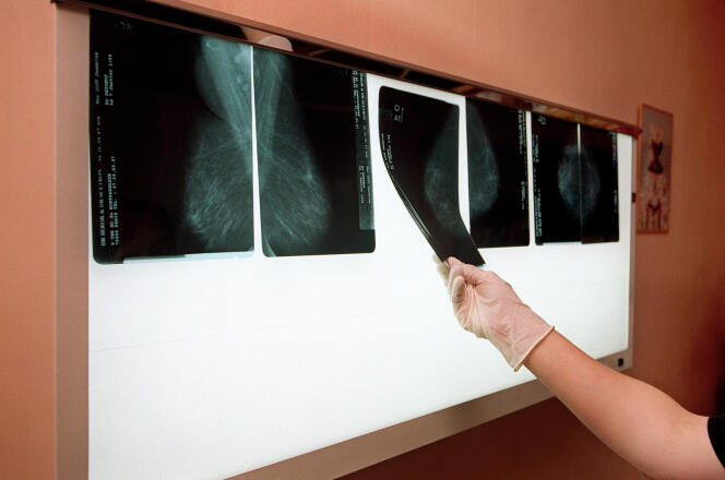 Un médecin examine, le 14 juillet 2001 dans son cabinet médical à Arcueil, près de Paris, les radios du sein d'une patiente afin de détecter un éventuel cancer.