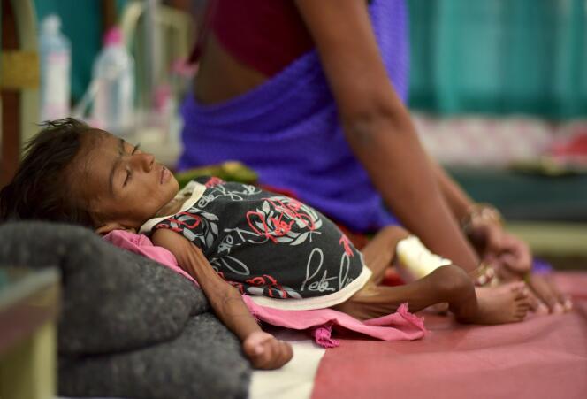 Un enfant de deux mois en situation de malnutrition en Inde.