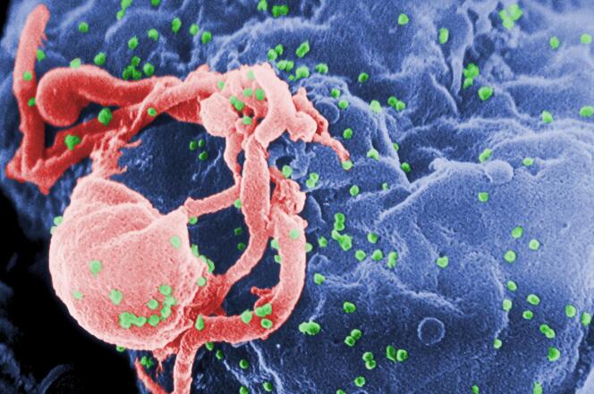 Cette photo montre une micrographie électronique du virus VIH-1 sur une surface cellulaire.