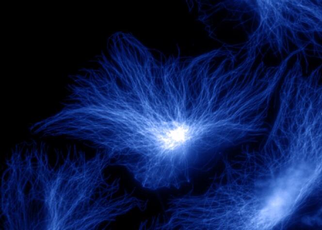 Microtubules.