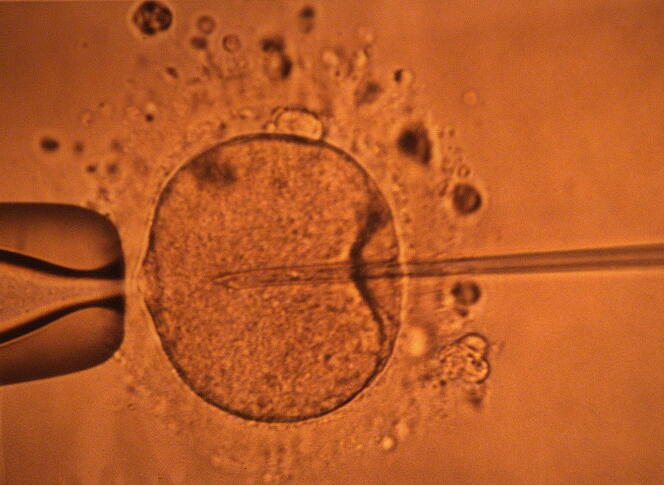 Micro-injection par pipette d'un spermatozoïde dans un ovocyte en 2000 au CECOS de Rennes.