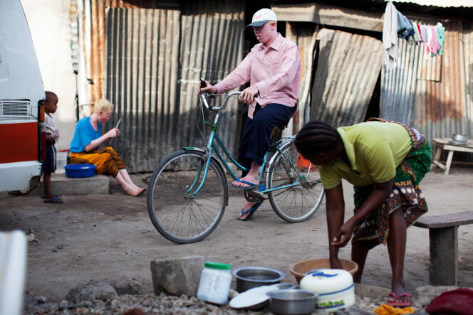 En Tanzanie, une personne sur 1 400 est atteinte d'albinisme.