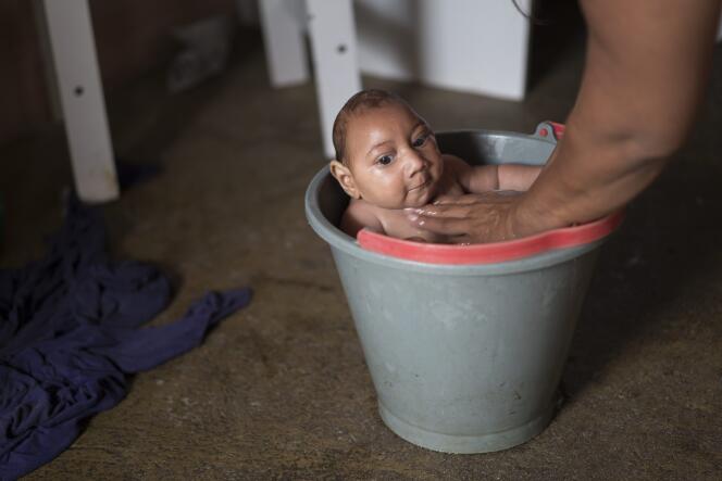 Un bébé contaminé in utero par le virus Zinka, à Poço Fundo (Etat du Minas Gerais), en décembre 2015.