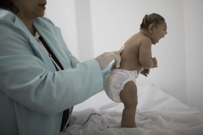 Un enfant âgé de trois mois et atteint de microcéphalie, au Brésil.