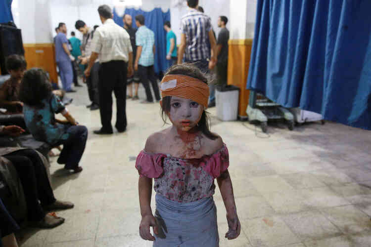 Deuxième prix, catégorie « Informations générales ». Une fillette, blessée lors d'un bombardement, attend dans un hôpital de Douma, dans la banlieue de Damas, le 22 août 2015.
