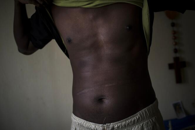 Un homme souhaitant rester anonyme, le 25 janvier, après sa détention dans l’une des prisons de Bujumbura.