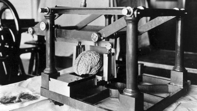 L'un parmi tant d'autres des cerveaux de l'invraisemblable collection sur laquelle s'est fondée une partie de la réputation de Julius Hallervorden, neurologue allemand.