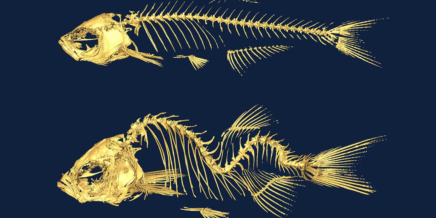 Scoliose Un Poisson Pilote Pour La Recherche Scoliose Un Poisson Pilote Pour La Recherche