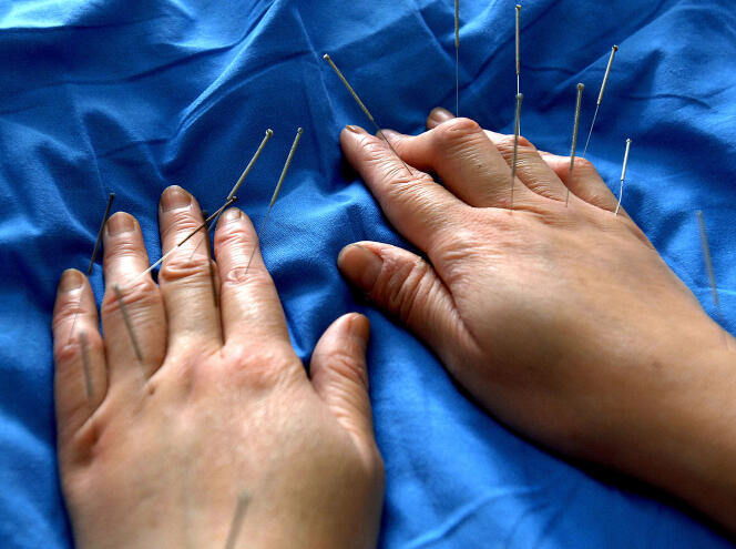 Traitement d’acupuncture dans un hôpital de médecine traditionnelle chinoise, à Hefei, en Chine.