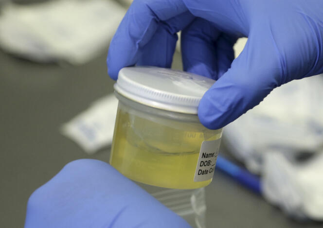 Test de détection du virus Zika sur un échantillon d’urine au département de santé de Floride à Miami Beach le 14 septembre 2016.