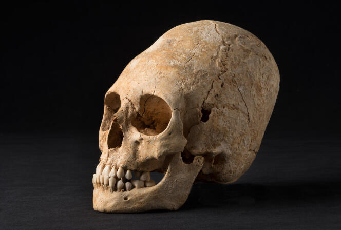 Crâne de Hun (Ve siècle) volontairement déformé mis au jour dans une nécropoledu Bas-Empire, à Obernai (Bas-Rhin), en 2013. Cette déformation intentionnelle nécessite l’utilisation de planchettes et de bandelettes qui compriment la tête dès le plus jeune âge.