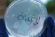 Ebola mort
