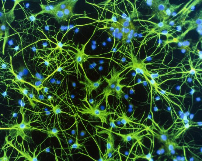 Cellules gliales qui peuvent être impliquées dans des perturbations du mécanisme de récompense dans le cerveau