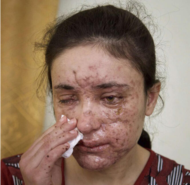 Lamiya Aji Bachar. Elle a été grièvement blessée en traversant un champ de mines au cours de sa fuite.