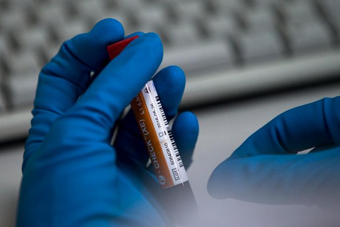 En mai 2016, un employé du laboratoire national russe de dépistage des drogues tient un flacon à Moscou, en Russie.
