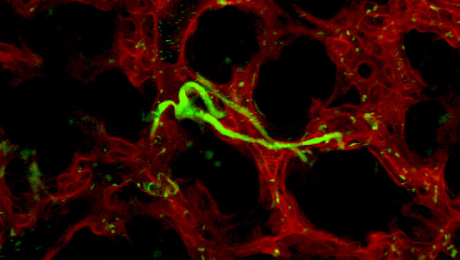 Production de plaquettes (en vert) dans la circulation pulmonaire observée par microscopie intravitale chez la souris