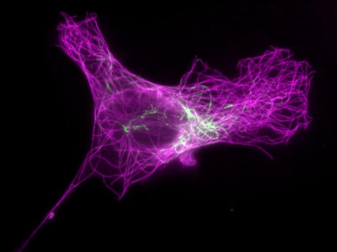 Les microtubules sont de nature chimique différente. Certaines (en vert) sont plus souples grâce à la présence de quelques atomes supplémentaires.. Ana Joaquina Jimenez/Manuel Théry/CEA