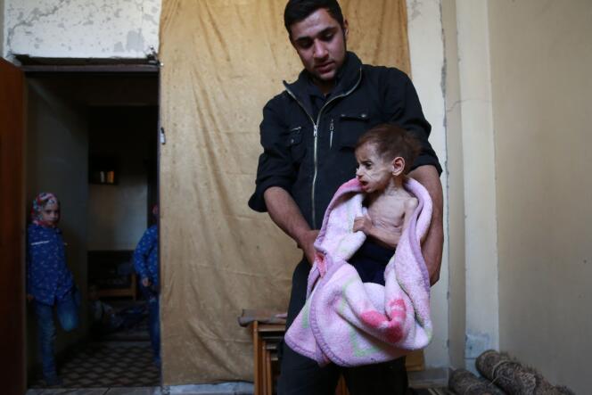 Hala, 2 ans, souffre de malnutrition, à la Ghouta, le 25 octobre.