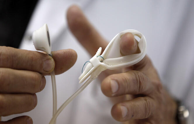 Un chirurgien tient un anneau gastrique à l’hôpital de Saint-Jean-d’Angély (Charente-Maritime), le 24 janvier 2013.