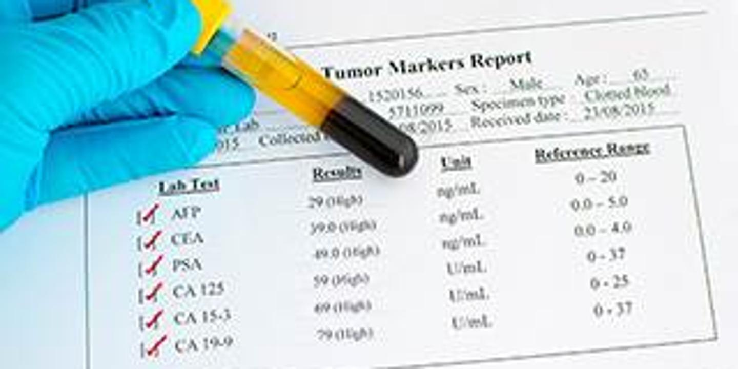 Cancer de la prostate un dosage ponctuel du psa ne sauve pas de vies