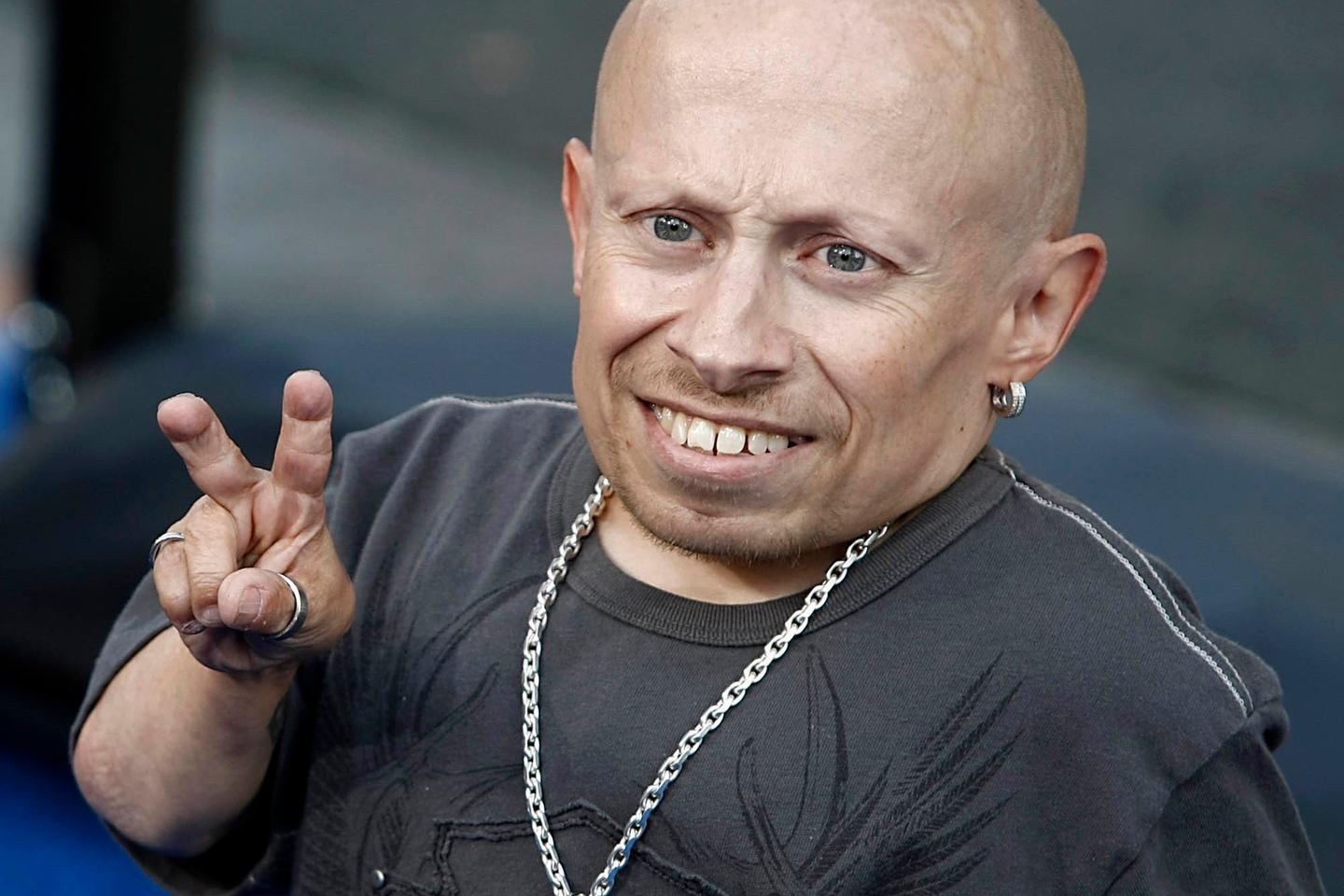 Nain chauve